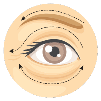 Oculoplasty surgery