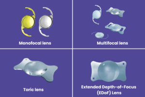 How to choose the right cataract lens (IOL)?