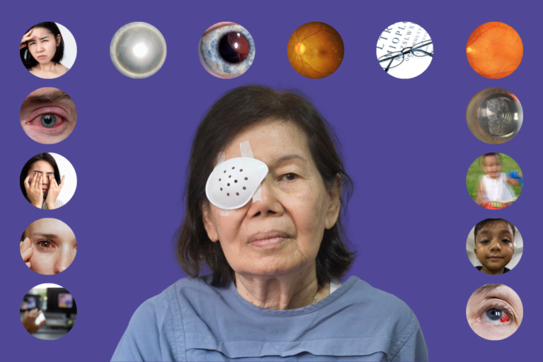 Risks & Complications after cataract surgery